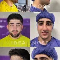 جراحی،زیبایی،بینی|خدمات آرایشگری و زیبایی|خرم‌آباد, |دیوار