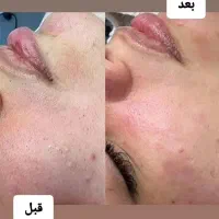 ارائه خدمات زیبایی|خدمات آرایشگری و زیبایی|کرمانشاه, |دیوار