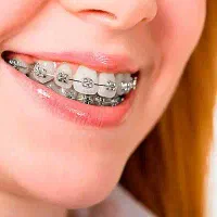 دستیار دندانپزشک