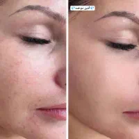 ضد آفتاب چی میزنی