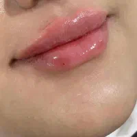 خدمات تخصصی پوست و مو در کلینیک فرسیما|خدمات آرایشگری و زیبایی|اسلام‌شهر, باغ فیض|دیوار