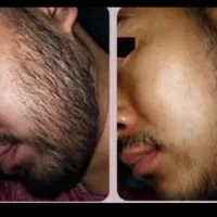 بدون درد کارو جمع کن