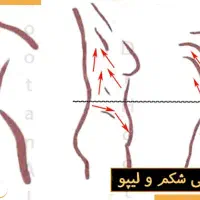 ماساژ ابدو و لیپو در کلینیک و یادر منزل خودتان
