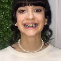 ارتودنسی برای همه.اقساط ماهانه فقط۲ میلیون