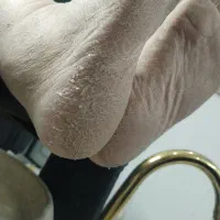 پدیکور درمانی ترک پا و دست فیشیال صورت تخفیف ویژه|خدمات آرایشگری و زیبایی|سبزوار, فیاض|دیوار