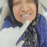 ساخت دندان مصنوعی با کم ترین قیمت|خدمات آرایشگری و زیبایی|تهران, جیحون|دیوار