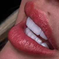 دندانپزشکی /کامپوزیت دندان /ایمپلنت و لمینت|خدمات آرایشگری و زیبایی|قم, سیدان|دیوار