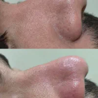 فیشیال و پاکسازی پوست|خدمات آرایشگری و زیبایی|پرند, فاز ۲|دیوار