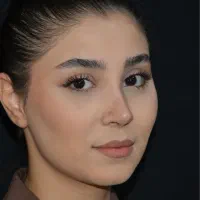 عمل جراحی بینی/متخصص زیباییent