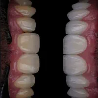 دندانپزشکی،ایمپلنت،ارتودنسی لمینت وکامپوزیت اقساطی