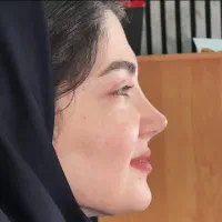 عمل بینی +لیپو+ابدو+ترنسفر+لیفت صورت اقساط