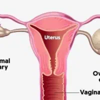 آموزش راهکار برای درمان مشکلات رحمی