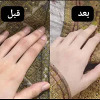 کرم وی آی پی تضمیمی|آرایشی، بهداشتی، درمانی|میبد, |دیوار