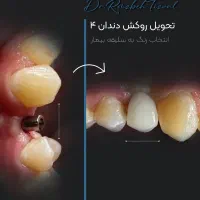 ادمین و گرافیست پیج اینستاگرام هستم|استخدام رایانه و فناوری اطلاعات|تهران, تجریش|دیوار