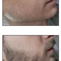 مو و ریش|خدمات آرایشگری و زیبایی|رفسنجان, |دیوار
