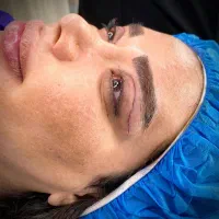 عمل بلفاروپلاستی/عمل بینی/ کاشت ابرو/ کاشت مو