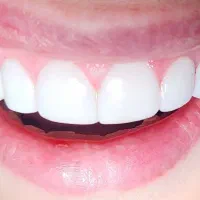 دندانپزشکی دکتر شکوه محمدزاده