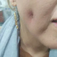 آموزش و خدمات زیبایی و درمانی|خدمات آرایشگری و زیبایی|خرمشهر, |دیوار