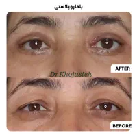 خدمات زیبایی اقساطی کلینیک دکتر خجسته|خدمات آرایشگری و زیبایی|گلبهار, شهر جدید گلبهار|دیوار