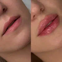 مدل جهت فیلر لیبل دار ،دارای تاییدیه بین المللی