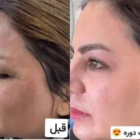 کرم ضد لک بیوممتیک ایتالیایی