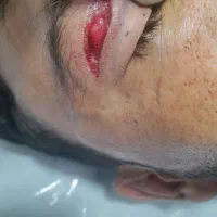 تزریقات وپانسمان در منزل