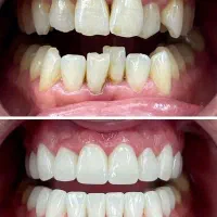 دندانپزشکی اقساط لمینت ایمپلنت و کلیه خدمات دندان|خدمات آرایشگری و زیبایی|مشهد, سجاد شهر|دیوار