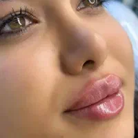 جشنواره ی پاییزه ژل ،بوتاکس،مزو|خدمات آرایشگری و زیبایی|شاهین‌شهر, فردوسی|دیوار