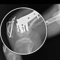 خدمات فزیوتراپی در منزل با قیمت مناسب