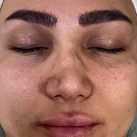 فیشال و(پاکسازی پوست)آبرسانی پوست
