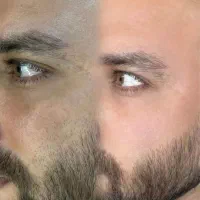 درمان مشکلات پوستی اقایان