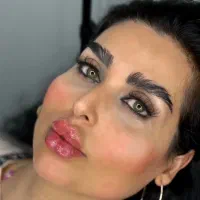 کیلینیک تخصصی ژل لب کات گونه زاویه فک