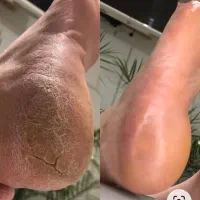 مدل رایگان برای پدیکور و لاک ژل پا به صورت رایگان|خدمات آرایشگری و زیبایی|تهران, دروس|دیوار