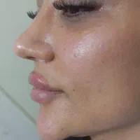 جوانساز پوست|خدمات آرایشگری و زیبایی|کرج, شهرک ظفر|دیوار