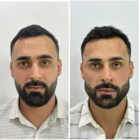 زاویه فک تخصصی( جشنواره نوروزی)