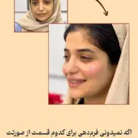 انجام کلیه خدمات تزریق بوتاکس ژل مزو وآنزیم