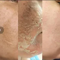 فیشیال و آلگاپیل و خالبرداری و هایفرکوئنسی|خدمات آرایشگری و زیبایی|شیراز, شریف‌آباد|دیوار