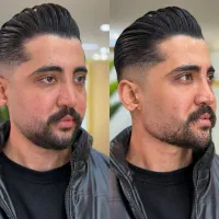 تزریق فیلر بوتاکس،نخ لیفتینگ بانصف قیمت بازار|خدمات آرایشگری و زیبایی|کرمانشاه, |دیوار