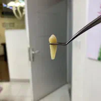 فروش دندان های خلفی4.5سالم|پزشکی|رشت, سعدی (تختی)|دیوار