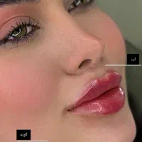 مرکز تخصصی تزریق بوتاکس فیلرگونه چشم زاویه آنزیم|خدمات آرایشگری و زیبایی|اندیشه, اندیشه فاز ۱|دیوار