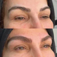 مدل میکروبلیدینگ/ فیبروز|خدمات آرایشگری و زیبایی|تهران, تهرانپارس جنوبی|دیوار