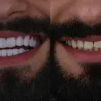 خدمات دندانی