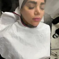 پاکسازی کامل صورت|خدمات آرایشگری و زیبایی|مشهد, یوسفیه|دیوار