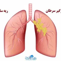 پاکسازی ریه بدون عوارض