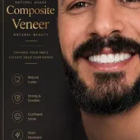 لمینت و کامپوزیت اقساطی