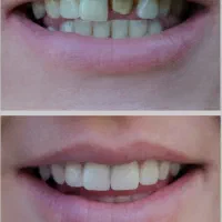 اموزش لابراتوار به صورت حرفه ای|خدمات آموزشی|تبریز, |دیوار