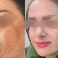 کرم عربی ۴۵ترکیب گیاهی جدیدترین کرم سال|آرایشی، بهداشتی، درمانی|یزد, |دیوار