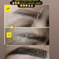 محلول رویش و رشد مجدد ابرو و مژه|آرایشی، بهداشتی، درمانی|مشهد, موسوی قوچانی|دیوار