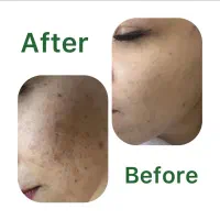 تخفیف ویژه یلدا و روز مادر فیشال تخصصی پوست|خدمات آرایشگری و زیبایی|مشهد, هفت تیر (آب و برق)|دیوار