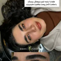 ریمو ابرو
